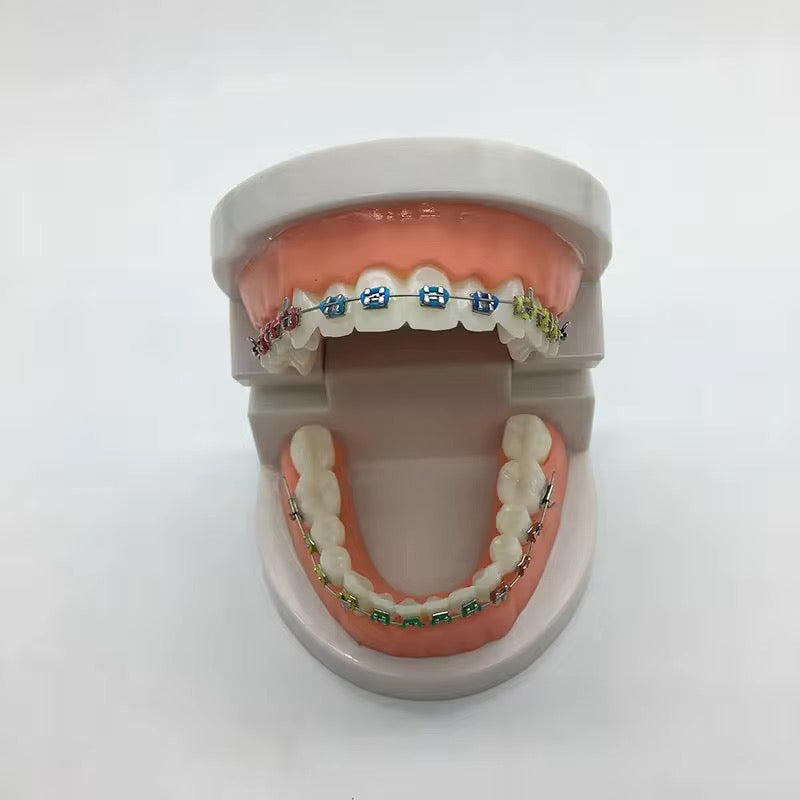 Faux Appareil Dentaire "Style Roth" – Accessoire Mode & Cosplay