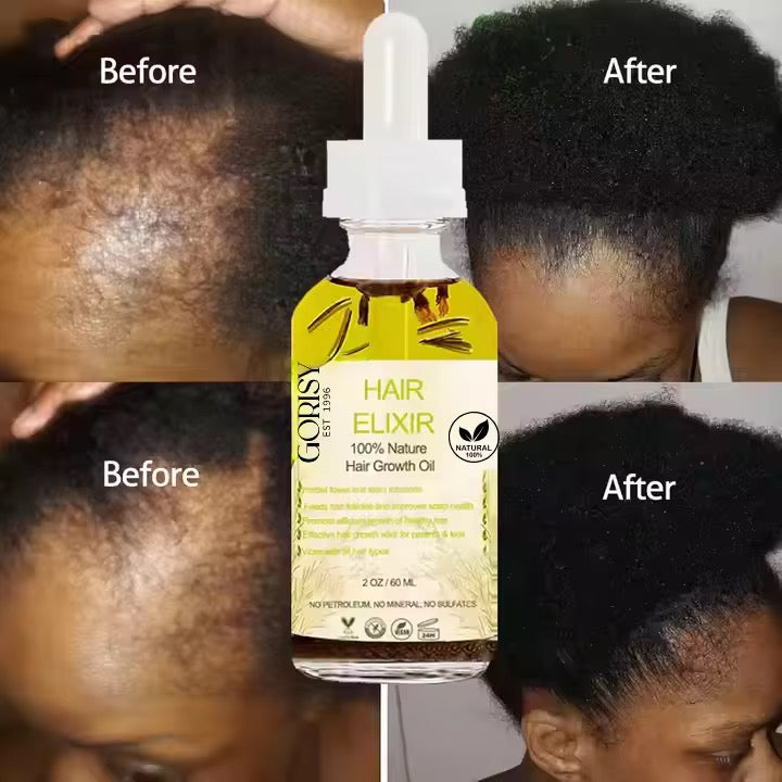 Sérum Stimulateur de Repousse – Huile de Ricin & Romarin Haute Performance